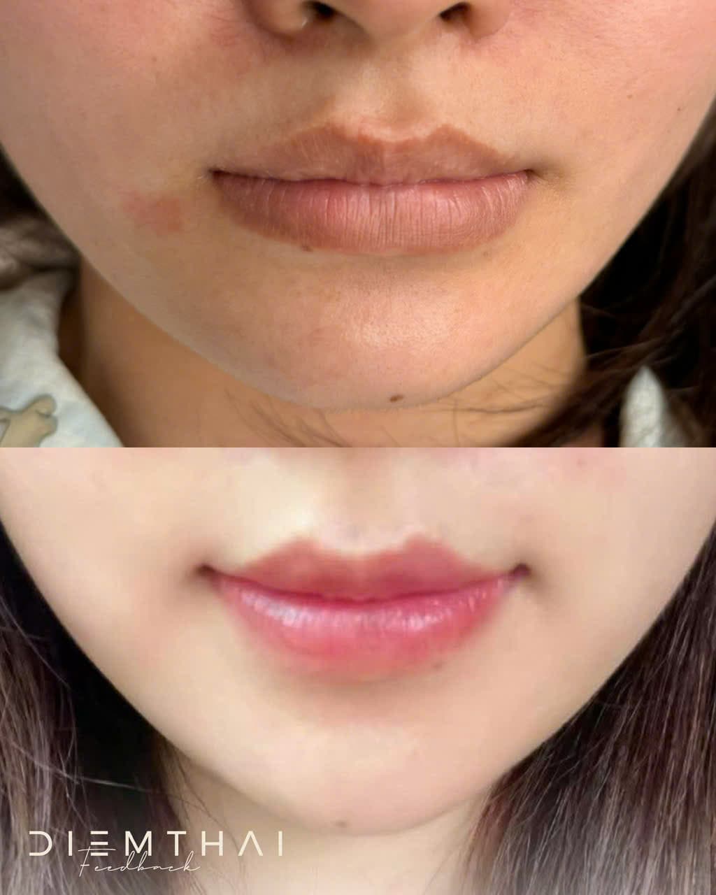 Natural Lip Blush