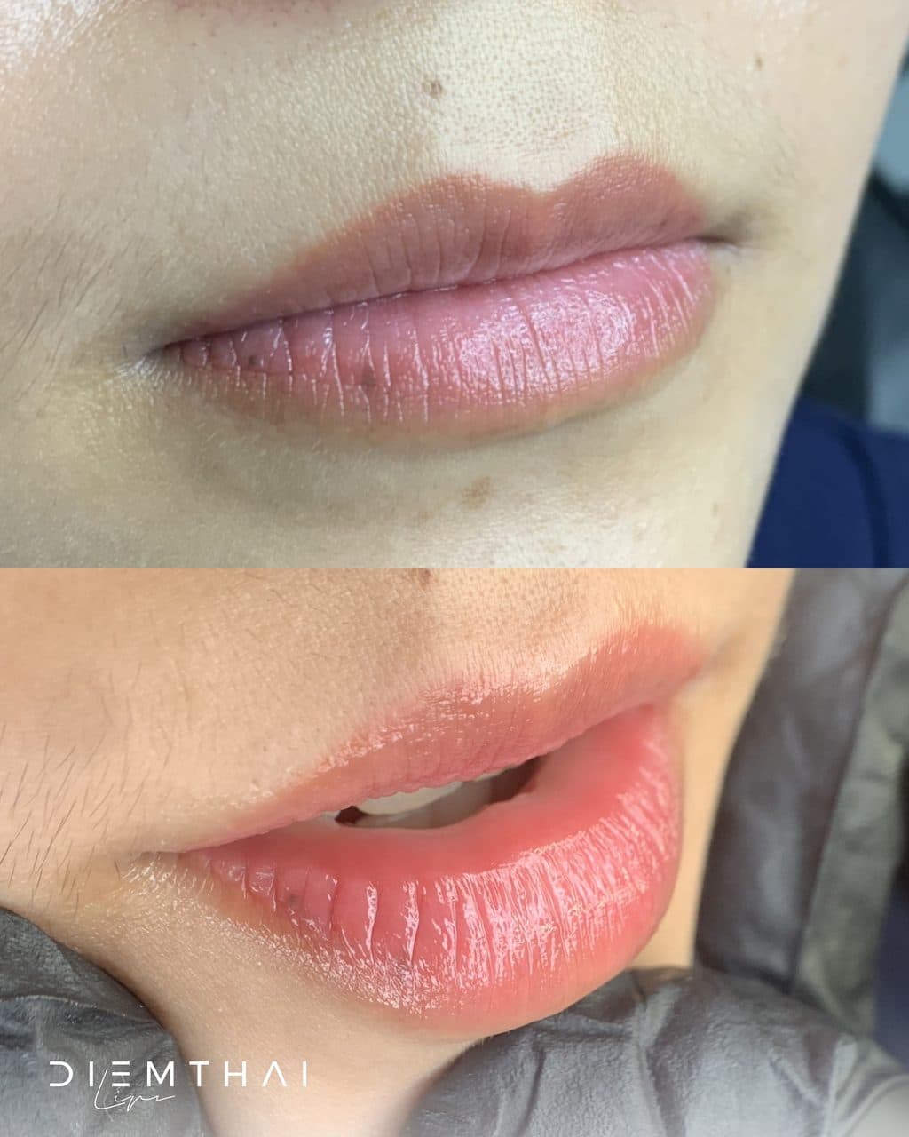 Lip Blush Before & After