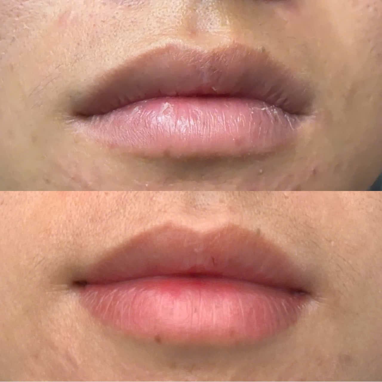 Khử thâm môi nam phục vụ khách Thường Tín — Diễm Thái Beauty Phú Xuyên